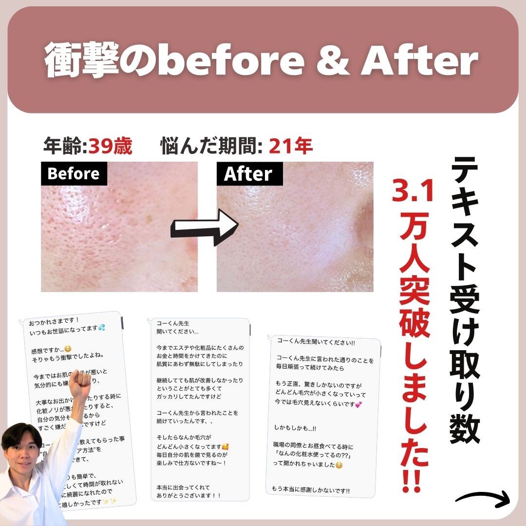 あなたの肌に合ったスキンケア💐コーくん先生 on LIPS 「【コレ知らない人まじ危険】こんな人は毛穴一生消えません。..あ..」(7枚目)