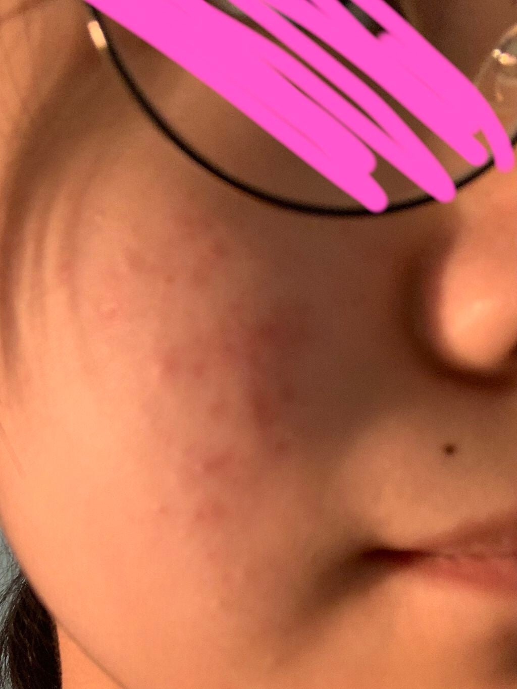 ハトムギ化粧水(ナチュリエ スキンコンディショナー R )/ナチュリエ/化粧水を使ったクチコミ(2枚目)