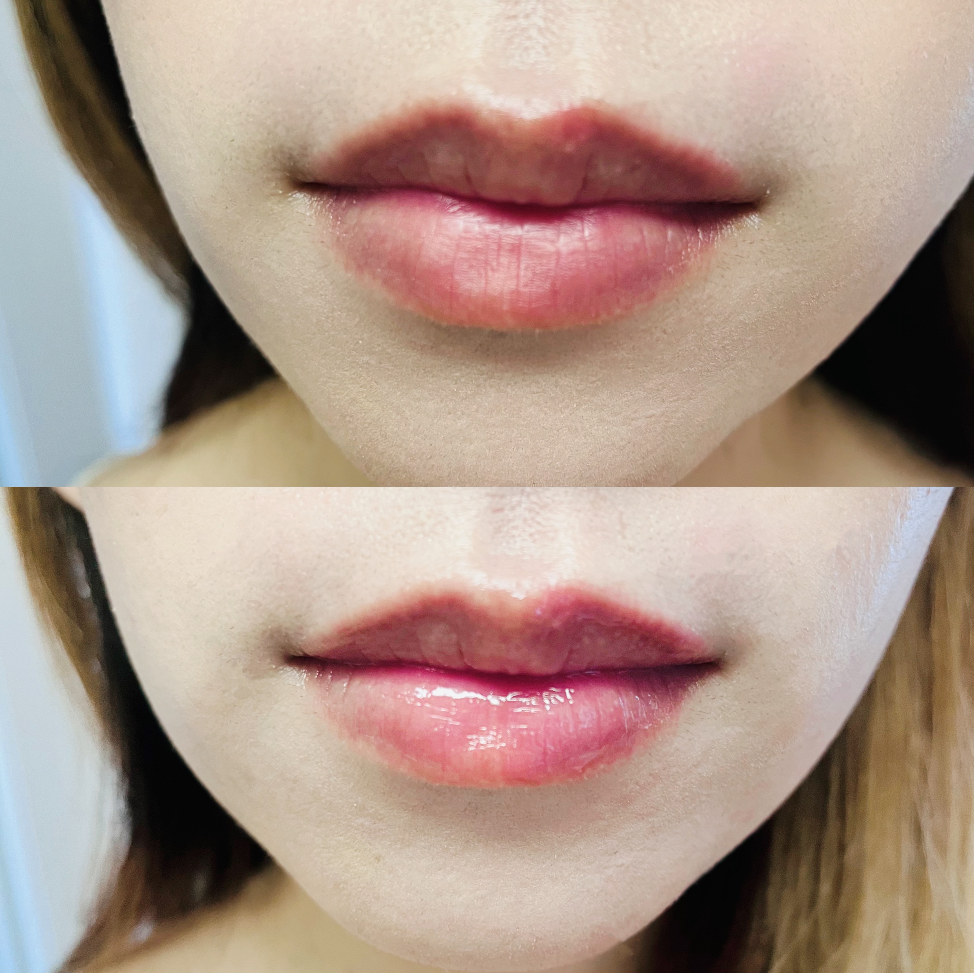 キューミ―ボムショットリッププランパー/AGARISM/リッププランパーを使ったクチコミ（3枚目）