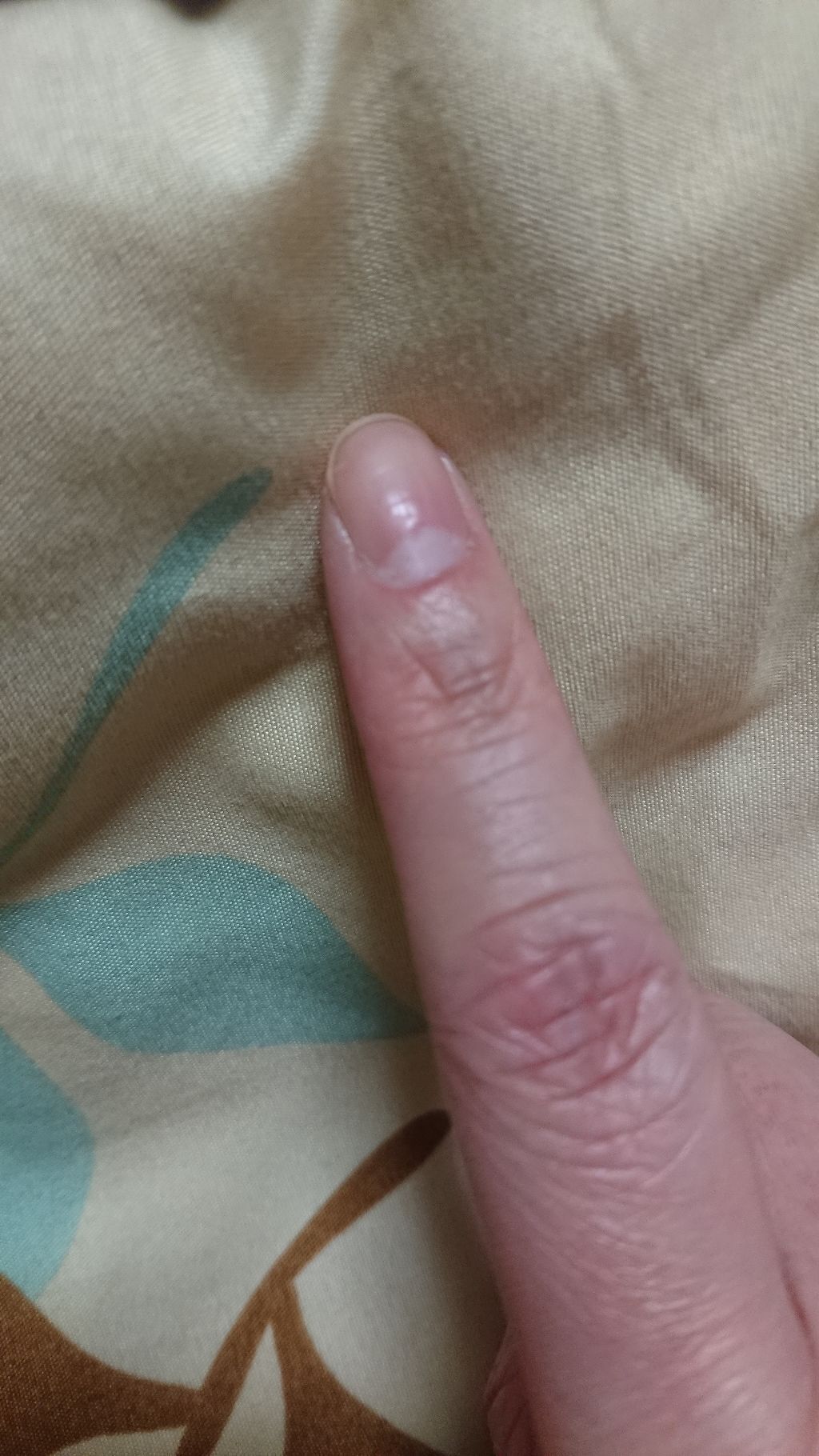 グロッシーコート/スキューズミー/オールインワンネイルを使ったクチコミ（3枚目）