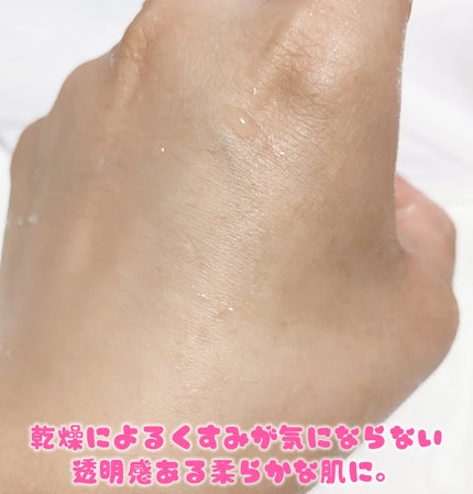 ピンクティーツリーライスシカウォッシュオフパック/APLIN/洗い流すパック・マスクを使ったクチコミ(6枚目)