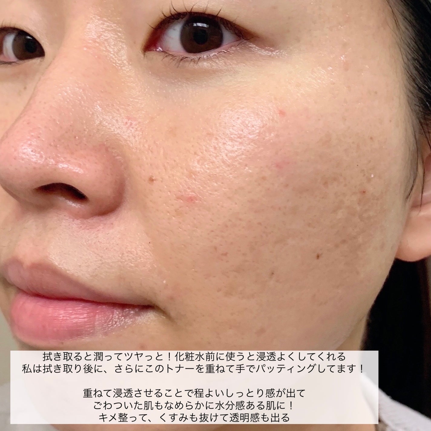 REJURAN リバランシングトナー 120ml /REJURAN COSMETICS/化粧水を使ったクチコミ(5枚目)