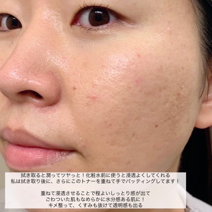 REJURAN リバランシングトナー 120ml /REJURAN COSMETICS/化粧水を使ったクチコミ(5枚目)