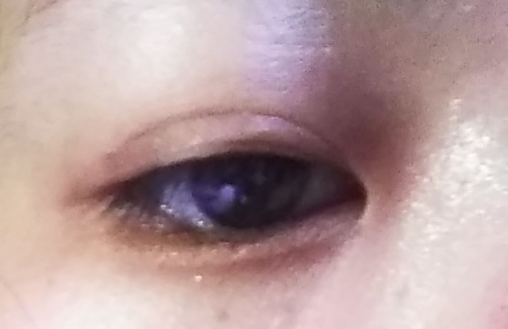 肌色タイプ/バンドエイド/その他を使ったクチコミ（2枚目）