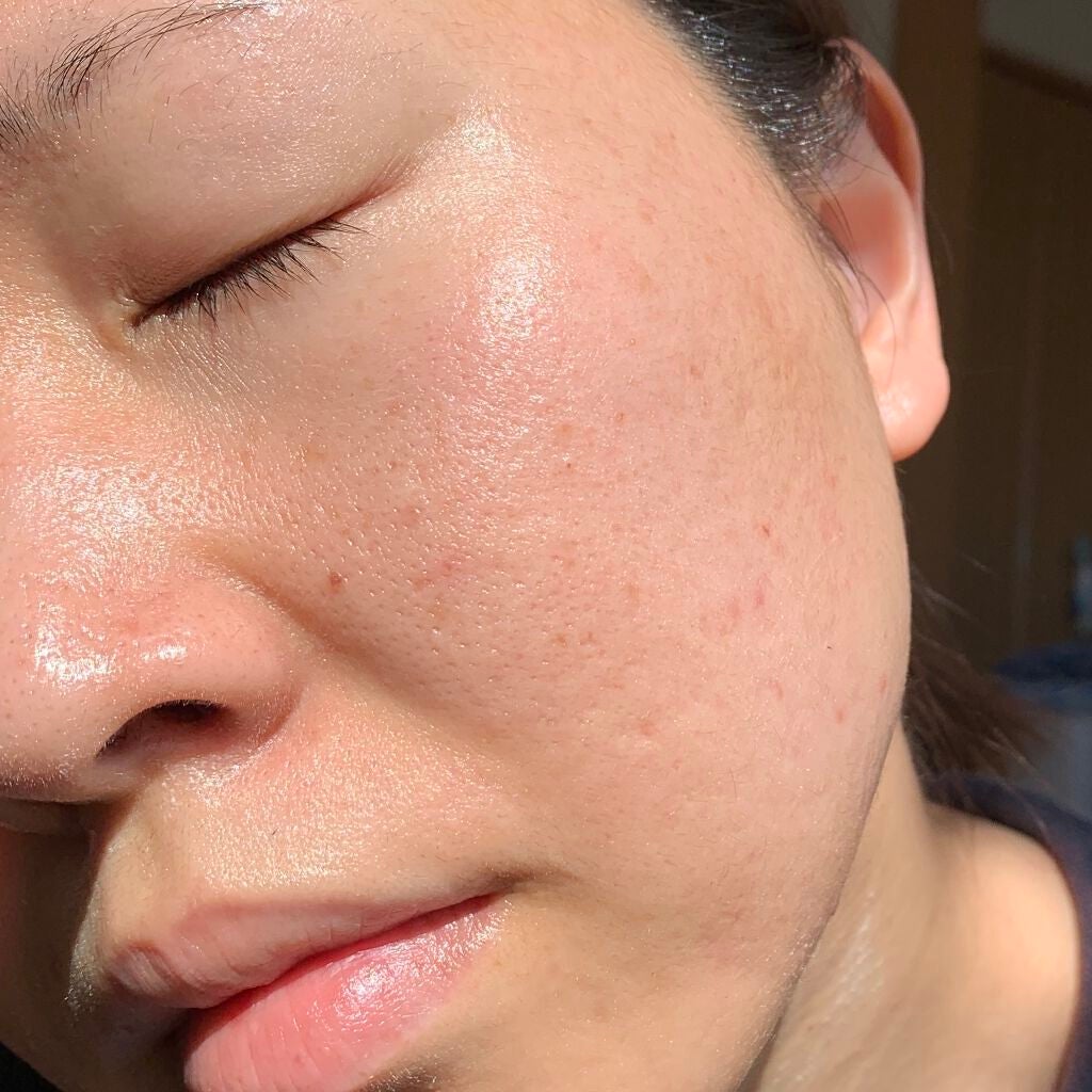 リアルキャロットブレミッシュクリアクリーム/APRILSKIN/フェイスクリームを使ったクチコミ(7枚目)