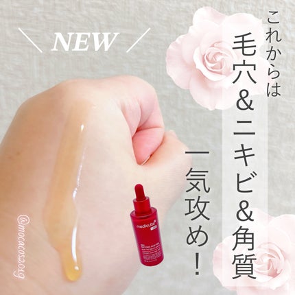 試してみた】レッドアクネピーリングセラム MEDICUBEの効果・肌 試してみた】レッドアクネピーリングセラム MEDICUBEの効果・肌
