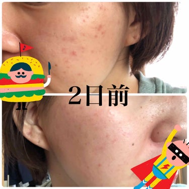 たまご on LIPS 「ご無沙汰しています！！最近バタバタとしており更新がおろそかにな..」（2枚目）