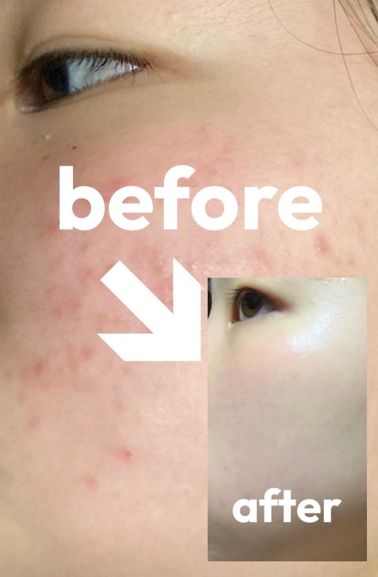 Mimori on LIPS 「私が肌のためにやったこと!✨①運動する⛹️♀️ 軽くても良い..」(1枚目)