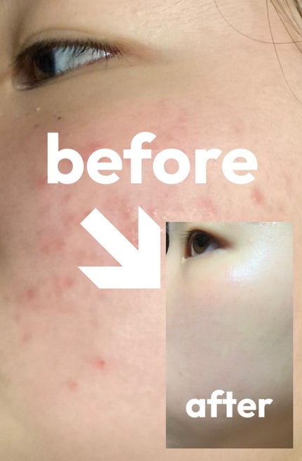 Mimori on LIPS 「私が肌のためにやったこと!✨①運動する⛹️♀️ 軽くても良い..」(1枚目)