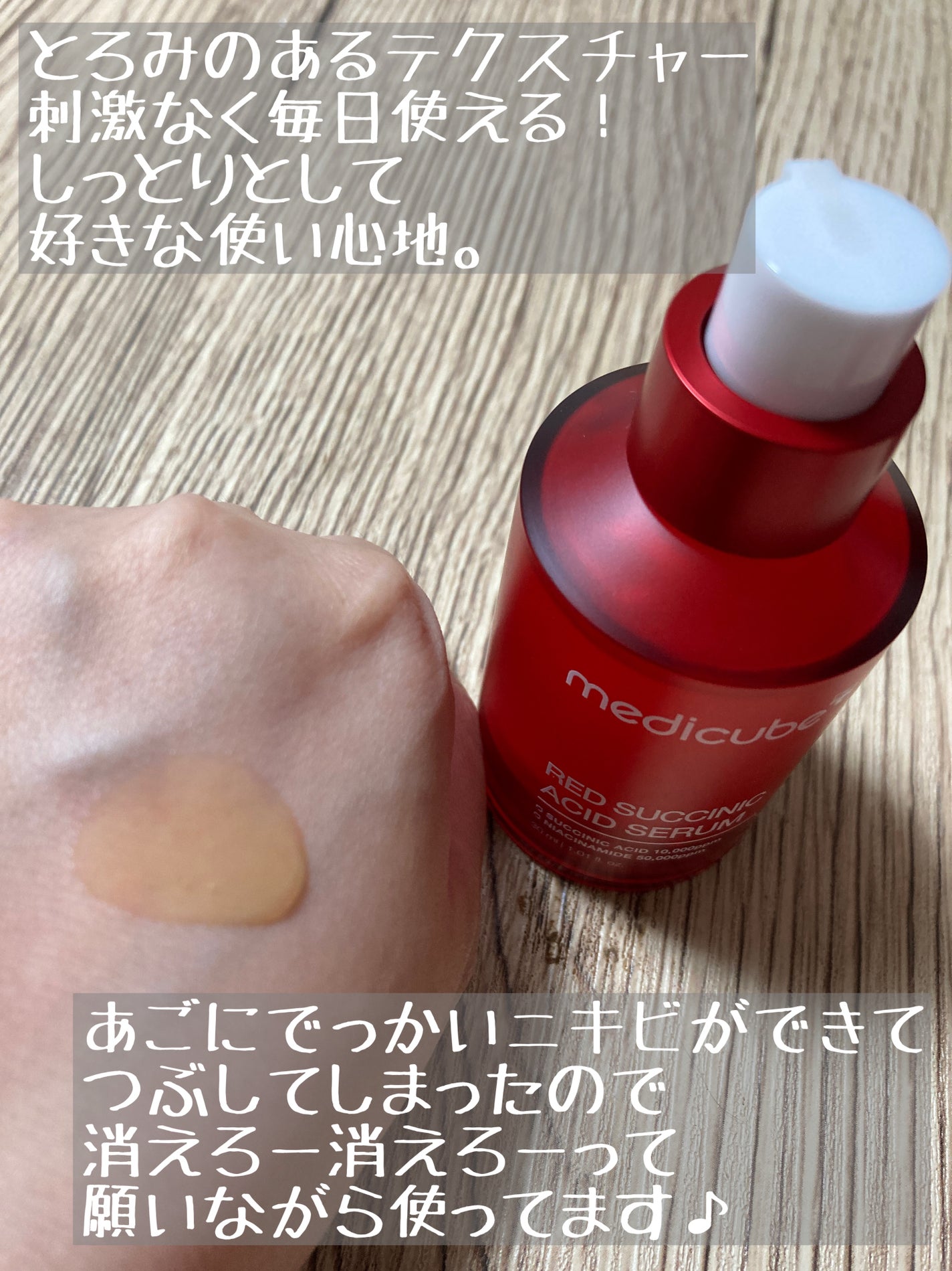 レッドアクネピーリングセラム/MEDICUBE/美容液を使ったクチコミ(5枚目)