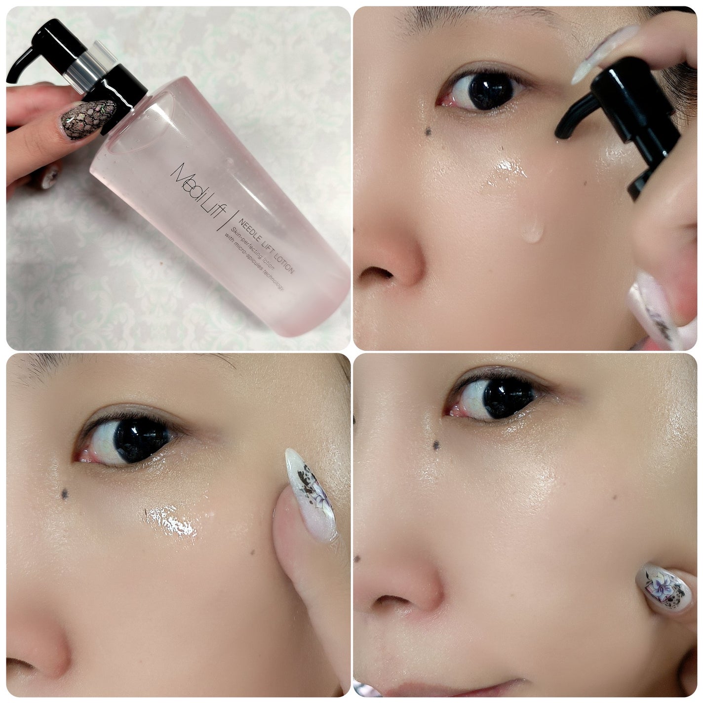 メディリフト ニードルリフトピールセラム/YA-MAN TOKYO JAPAN/美容液を使ったクチコミ(6枚目)