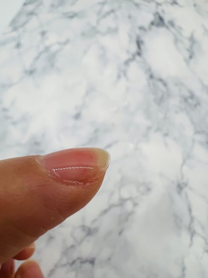 エテュセ クイックケアコート/ettusais/ネイルオイル・トリートメントを使ったクチコミ(2枚目)