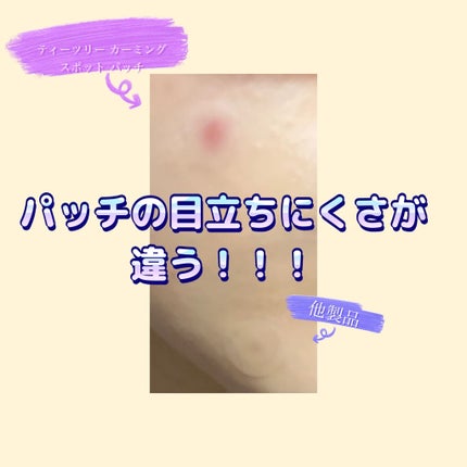 ãã£ãŒããªãŒã«ãŒãã³ã°ã¹ãããããã/MEDIHEAL/ãã®ä»ã¹ãã³ã±ã¢ã䜿ã£ãã¯ãã³ãïŒ4æç®ïŒ