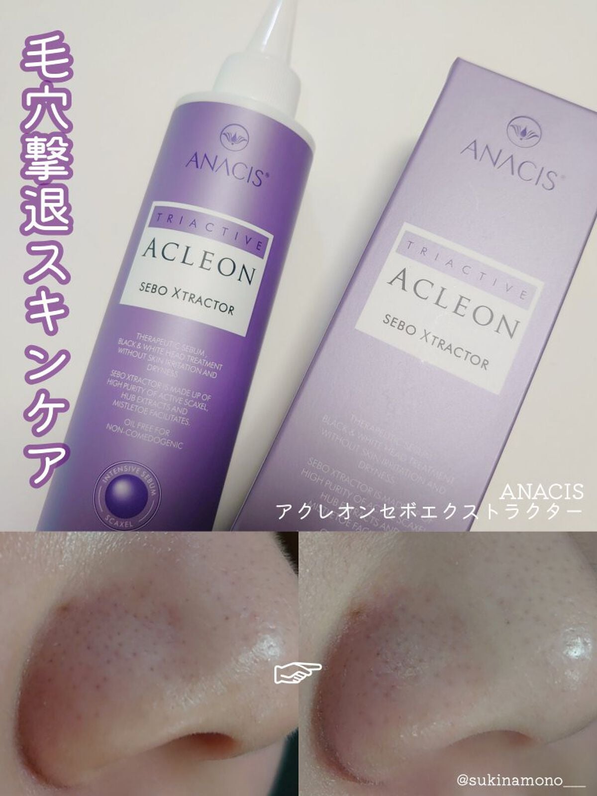 アクレオンセボエクストラクター/ANACIS/その他スキンケアを使ったクチコミ(1枚目)