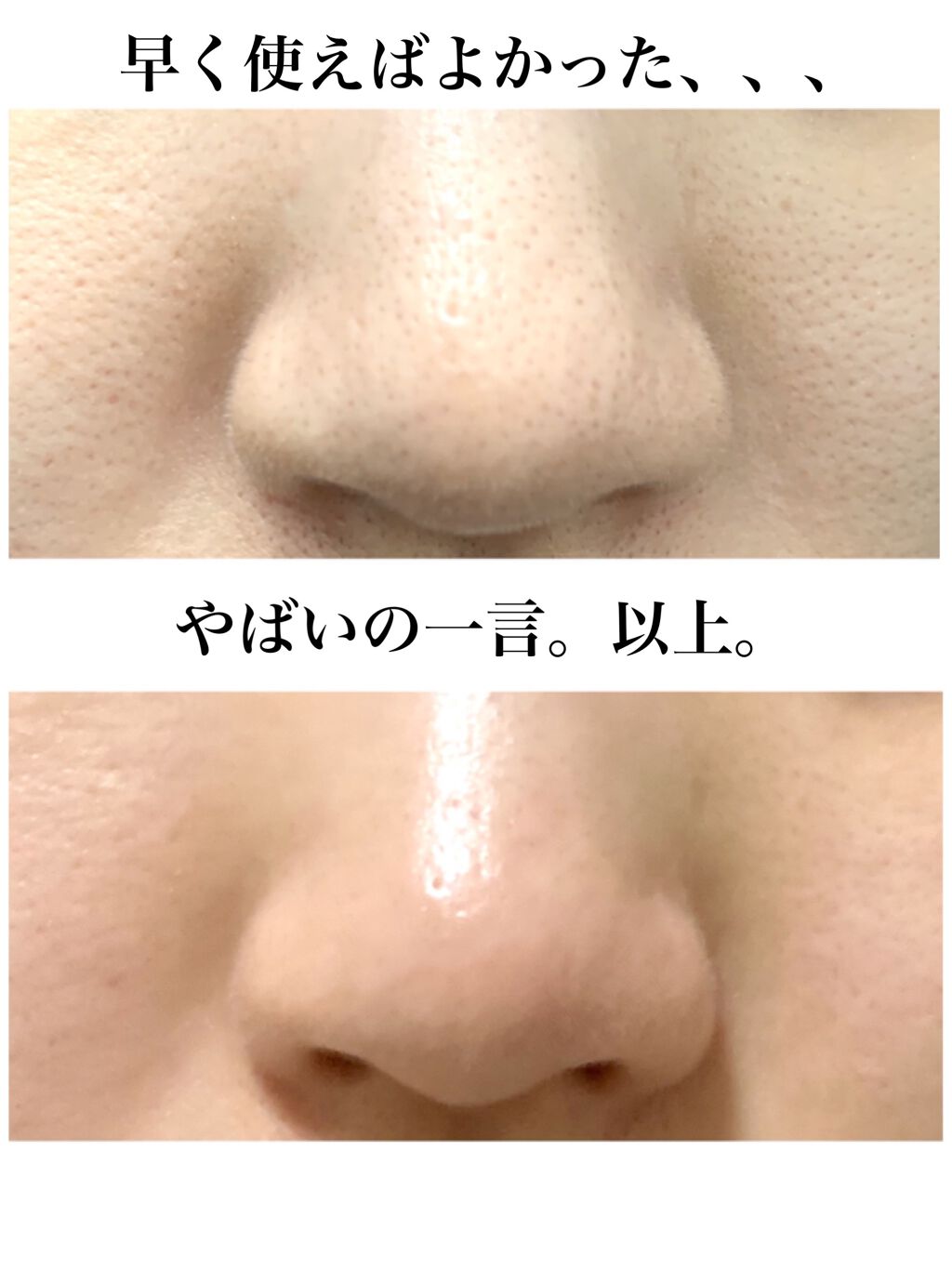 ホホバオイル/無印良品/ボディオイルを使ったクチコミ（1枚目）