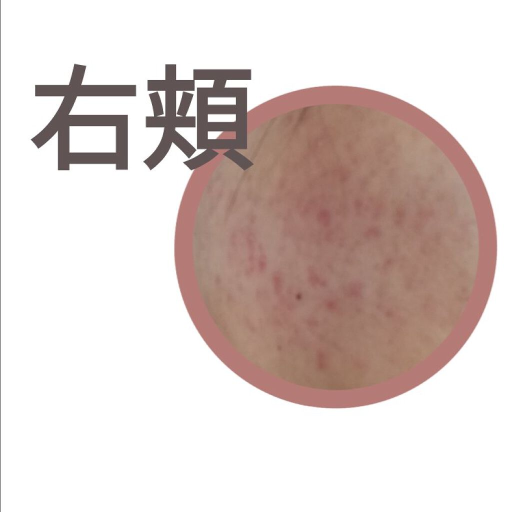 DHC マルチビタミン/DHC/美容サプリメントを使ったクチコミ(3枚目)