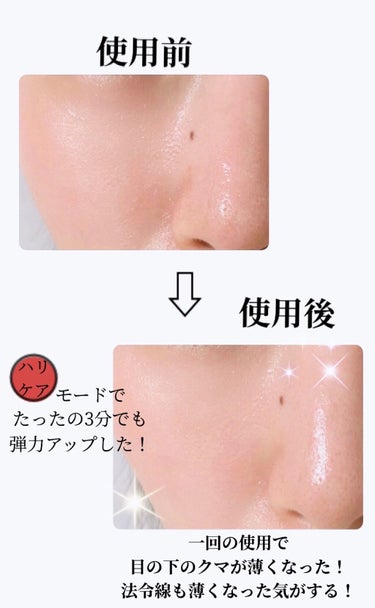 スキンライトセラピーII/Makeon/美顔器・マッサージを使ったクチコミ（7枚目）