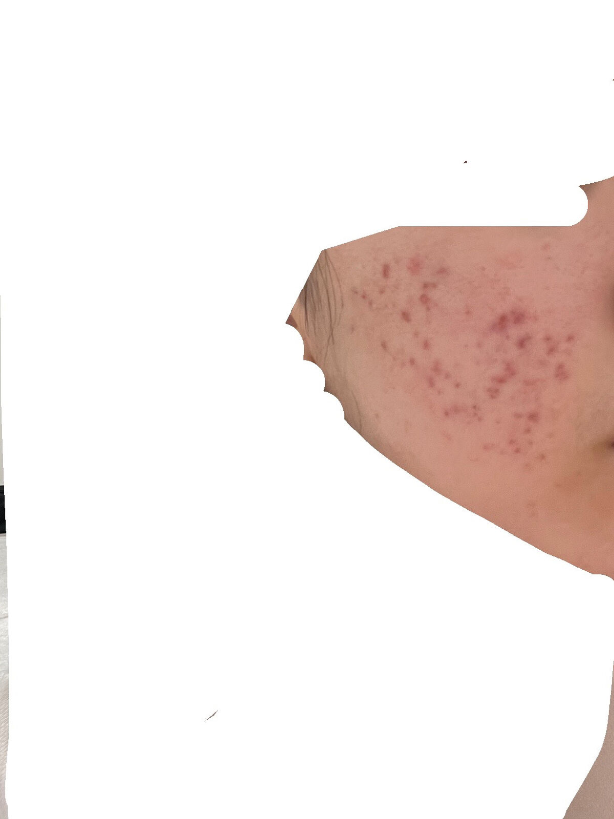 バランスアップ ローション(III)/アクアレーベル/化粧水を使ったクチコミ（3枚目）