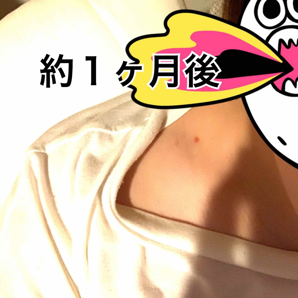 Nexcare/3M nexcare/にきびパッチを使ったクチコミ(4枚目)