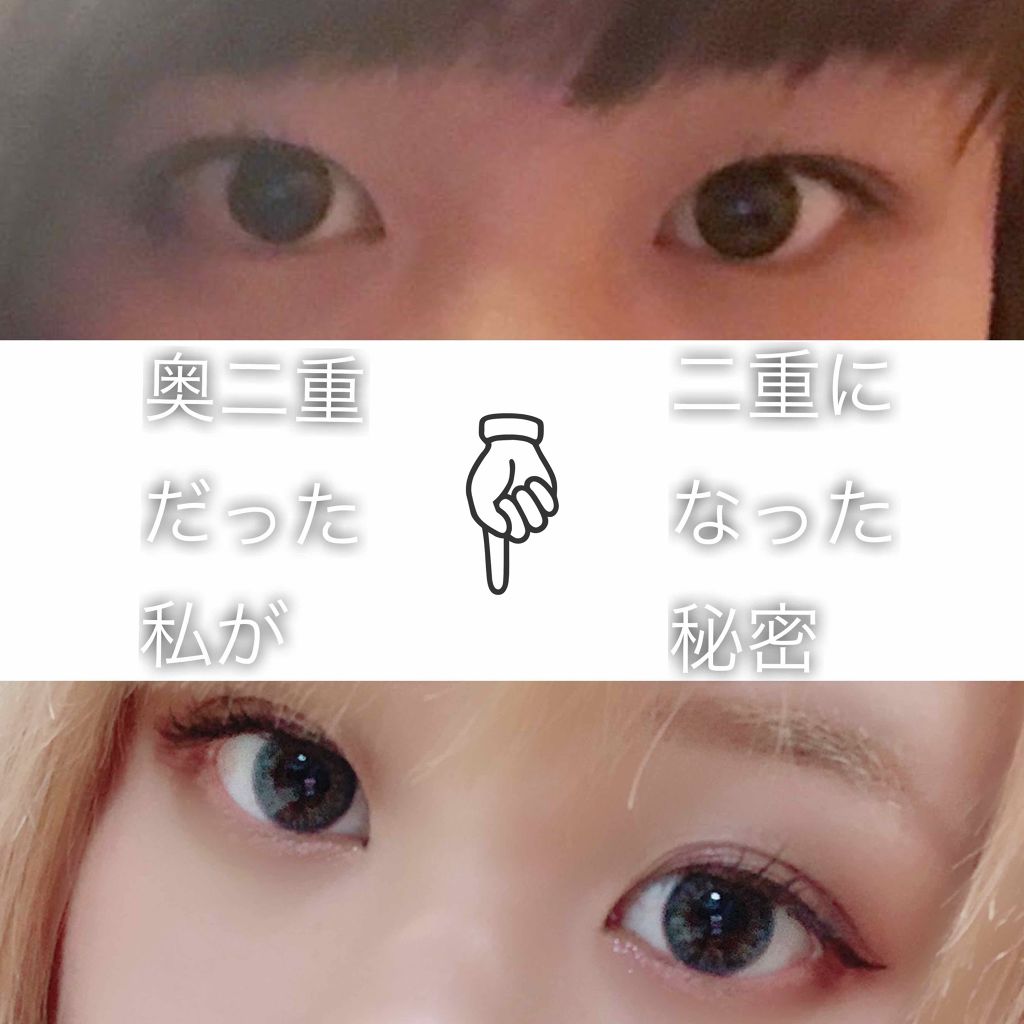 【旧品】オリシキ アイリッドスキンフィルム/D-UP/二重まぶた用アイテムを使ったクチコミ(1枚目)