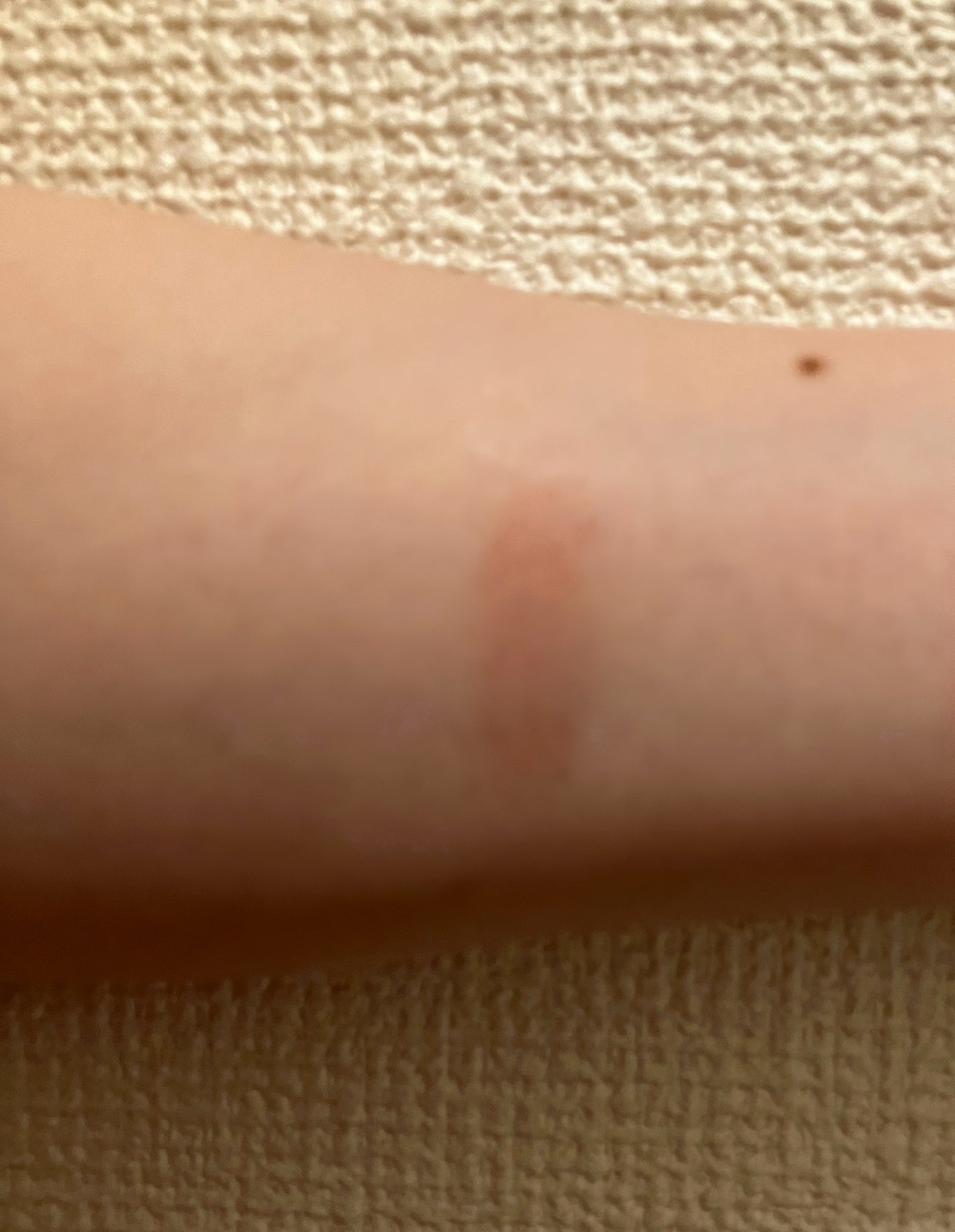 ケアリップチュアル/nuse/口紅を使ったクチコミ(5枚目)