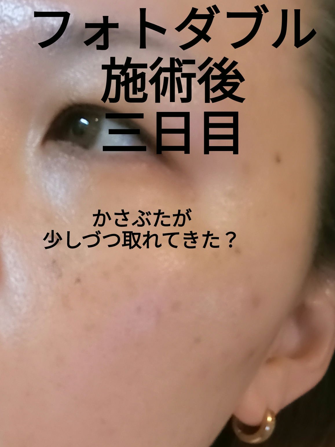 ダルバ ホワイトトリュフファーストスプレーセラム/ダルバ/ミスト状化粧水を使ったクチコミ（1枚目）