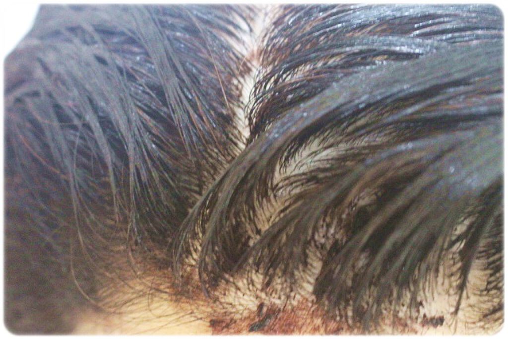 オールインワン カラートリートメント/マイナチュレ/ヘアカラーを使ったクチコミ（1枚目）