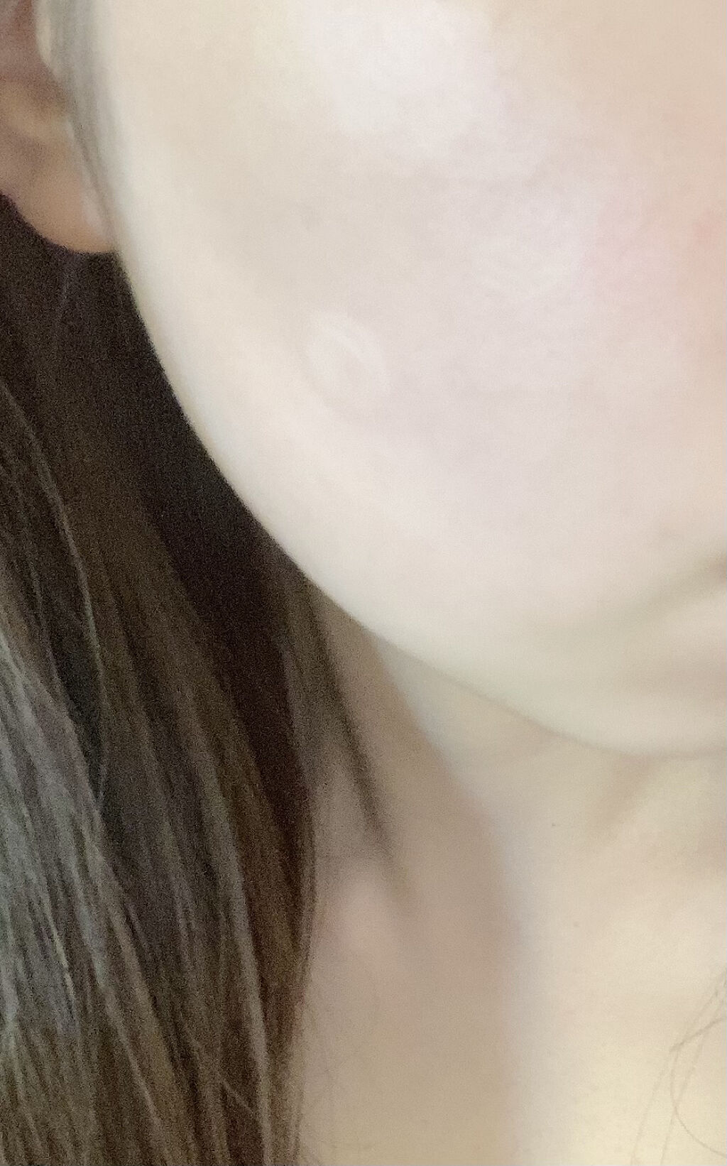 薬用ニキビケア スポッツクリーム/アクネスラボ/フェイスクリームを使ったクチコミ（3枚目）