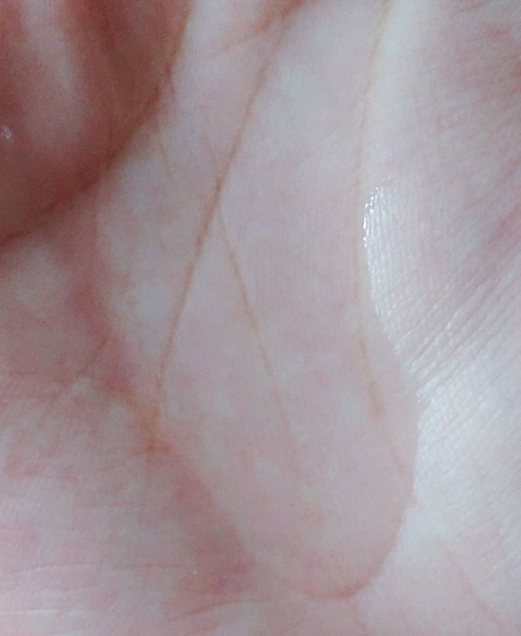 モイストバランス ローション/ACSEINE/化粧水を使ったクチコミ(2枚目)