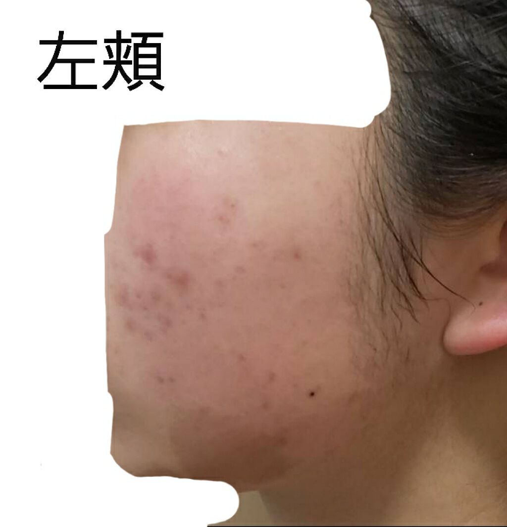 ハトムギ化粧水(ナチュリエ スキンコンディショナー R )/ナチュリエ/化粧水を使ったクチコミ（2枚目）