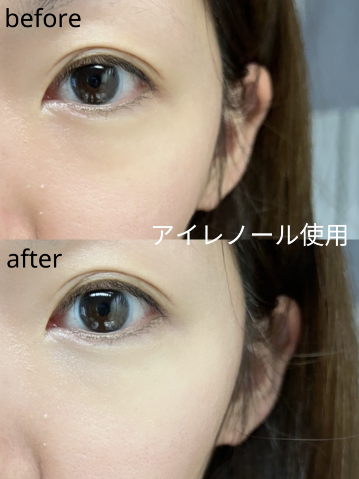 アイレノール クマクリーム/IRENOL/アイケア・アイクリームを使ったクチコミ（2枚目）