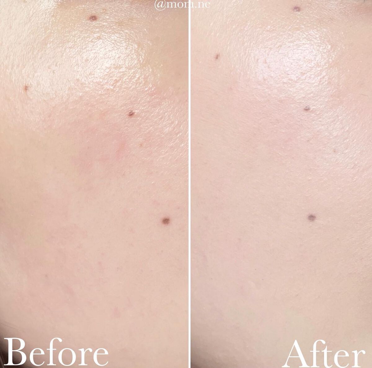 フィットミー リキッドファンデーション R/MAYBELLINE NEW YORK/リキッドファンデーションを使ったクチコミ(3枚目)