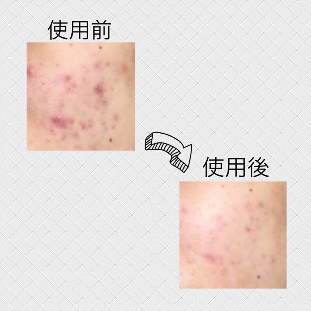 ザ・タイムR アクア/IPSA/化粧水を使ったクチコミ(3枚目)