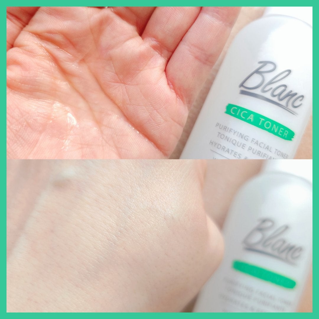 マジックシカトナー/ブラン/化粧水を使ったクチコミ(5枚目)