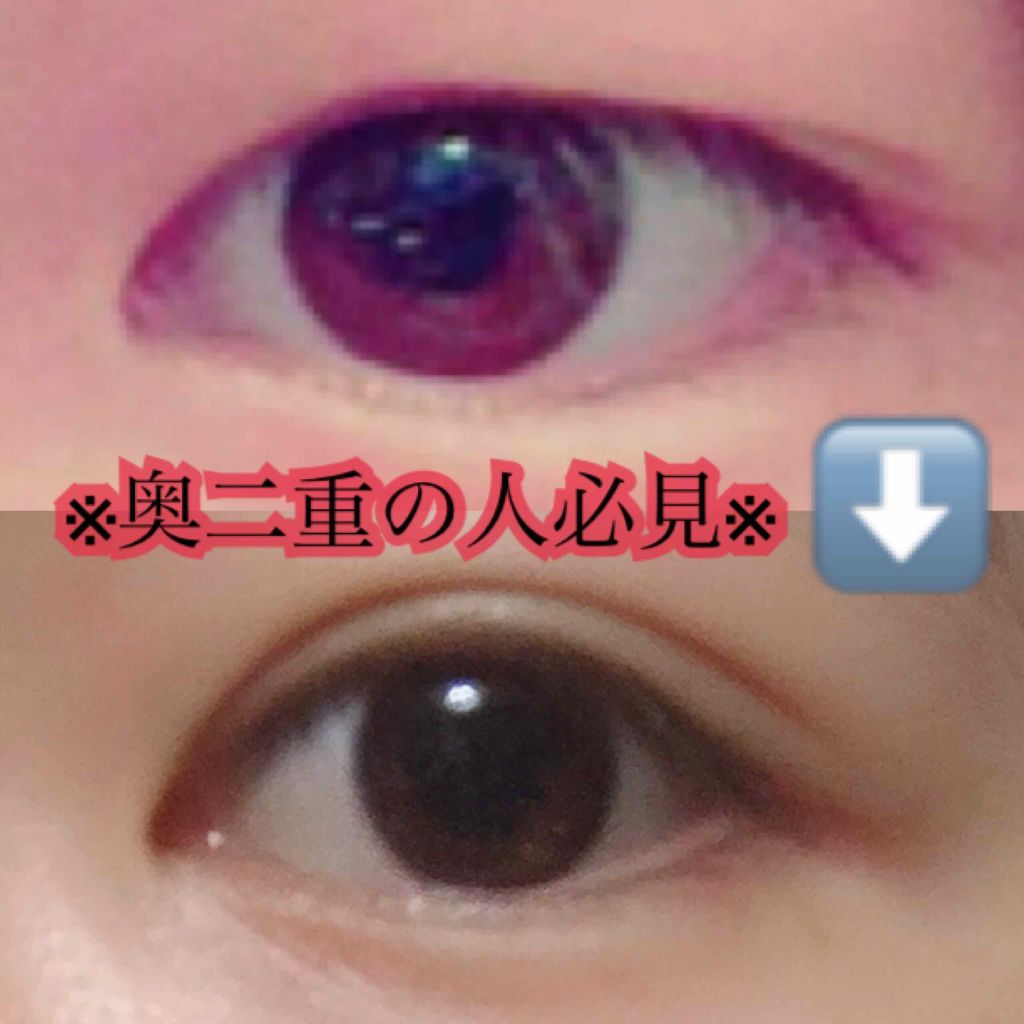 のびーるアイテープ(絆創膏タイプ、レギュラー)/DAISO/二重まぶた用アイテムを使ったクチコミ(1枚目)