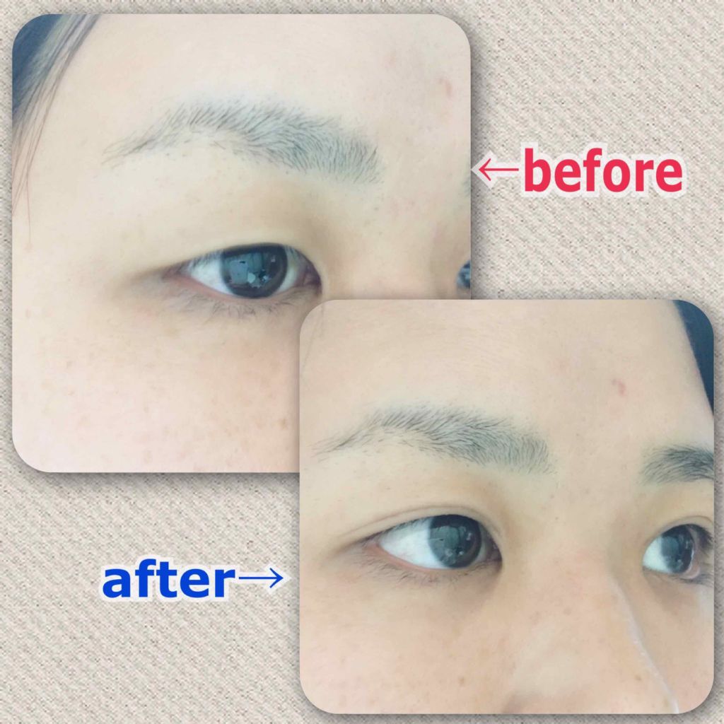 アイトーク 大人のまぶたコントロール/アイトーク/二重まぶた用アイテムを使ったクチコミ(3枚目)