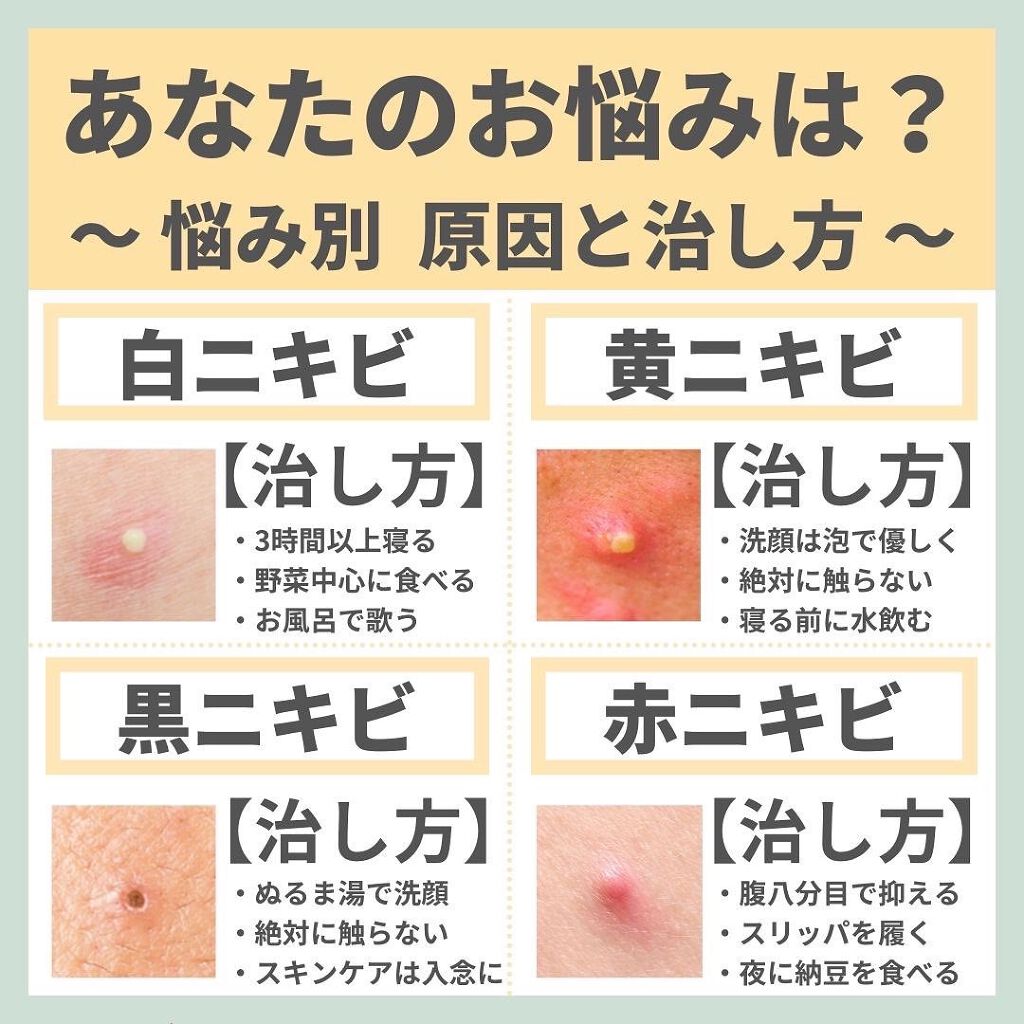 あなたの肌に合ったスキンケア💐コーくん先生 on LIPS 「あなたはどのニキビでしたか?🙌🙌...あなたの肌荒れが治らない..」(2枚目)