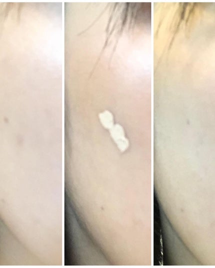 タトゥーウォータープルーフスカーコンシーラー/フォレンコス/リキッドコンシーラーを使ったクチコミ(3枚目)