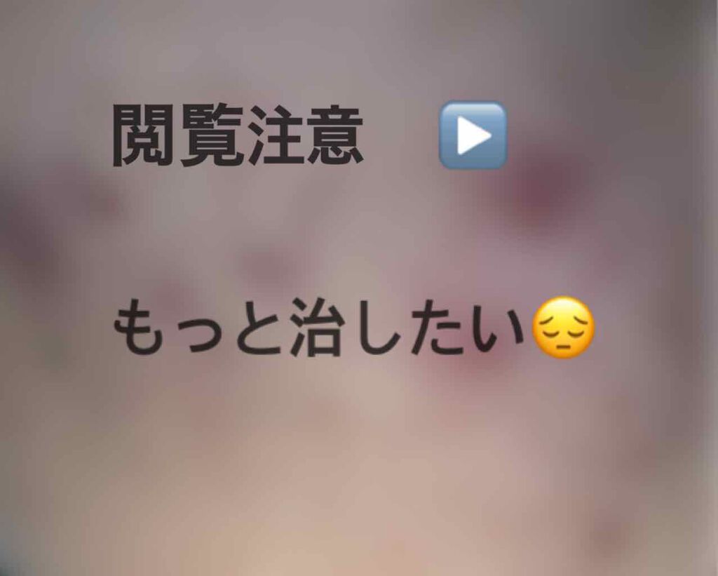 あぃら on LIPS 「【こんにちは🙋♀️💖あぃらです☼☁*°⠀】・今回は私がここま..」(1枚目)