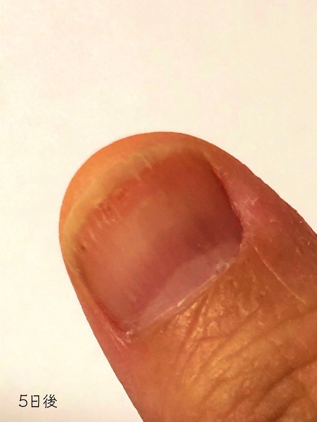 デイケアオイル/Dr.Nail/ネイルオイル・トリートメントを使ったクチコミ(3枚目)