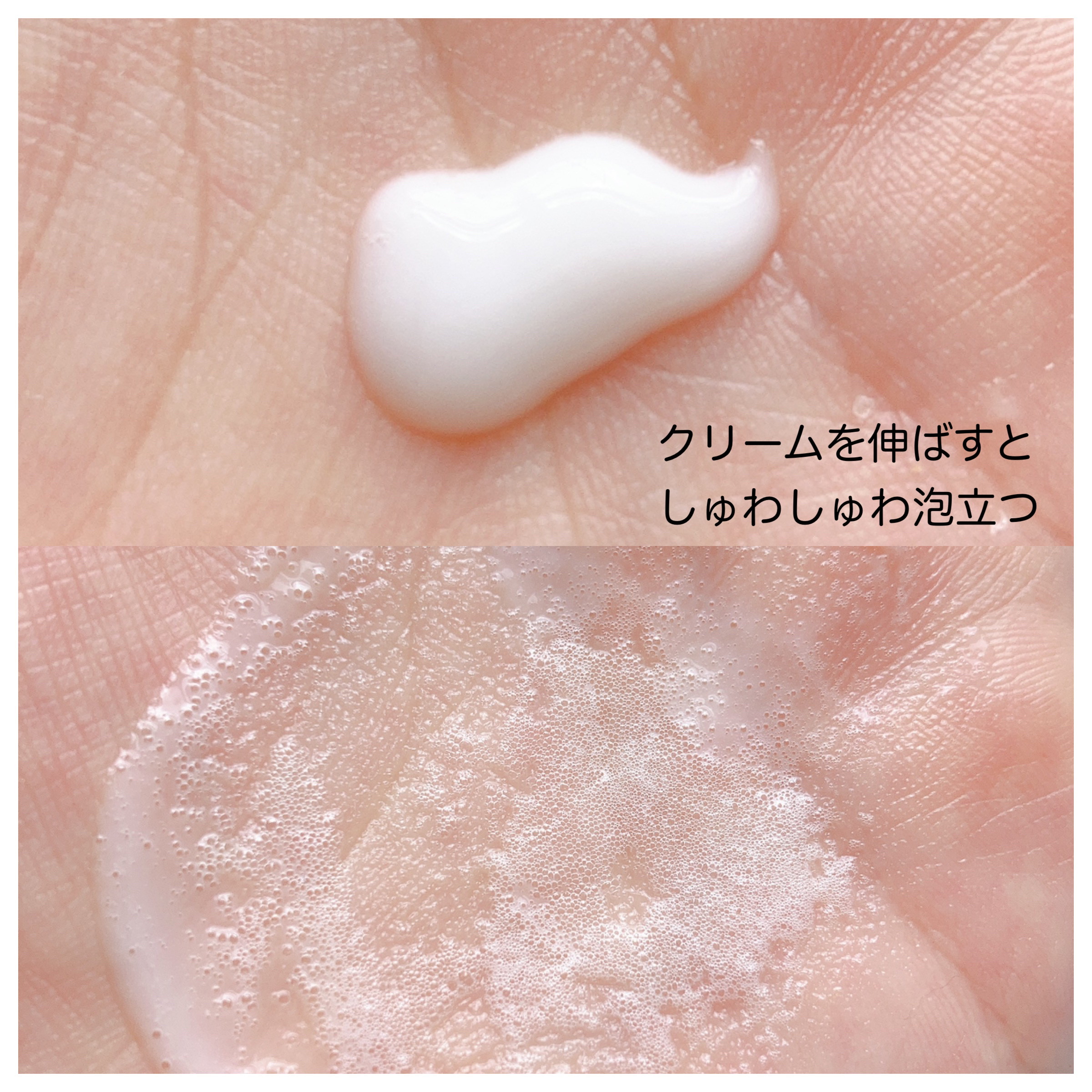 ティーツリースーディングバブルエッセンス/WellDerma/美容液を使ったクチコミ（2枚目）