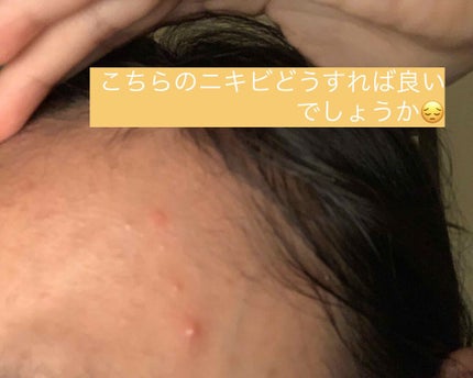 を使ったクチコミ(1枚目)