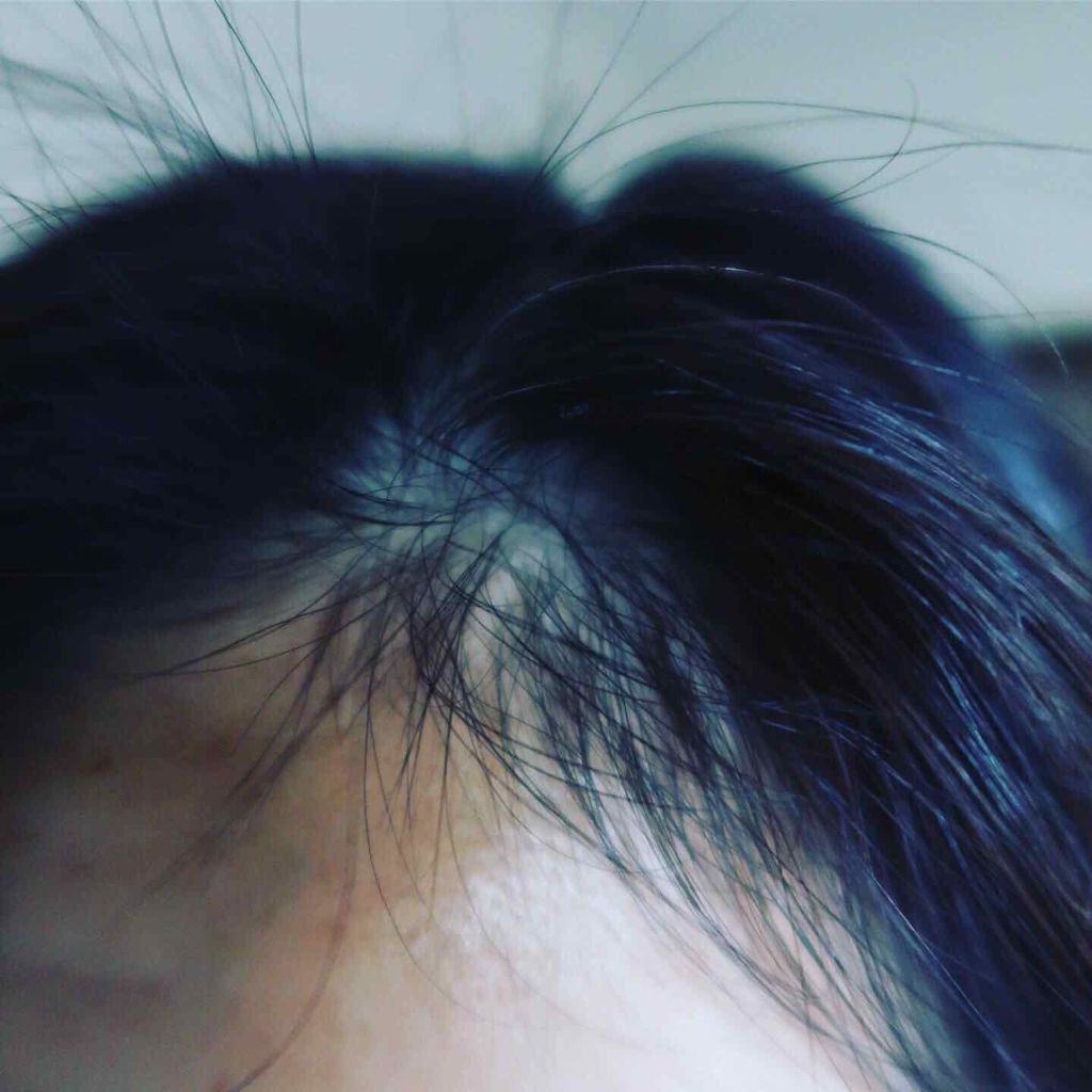 薬用 地肌 エッセンス/ラサーナ/頭皮ローションを使ったクチコミ(4枚目)