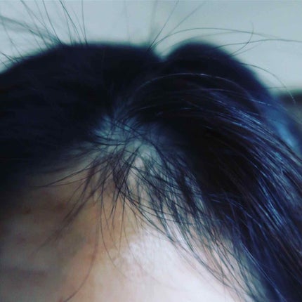 薬用 地肌 エッセンス/ラサーナ/頭皮ローションを使ったクチコミ(4枚目)