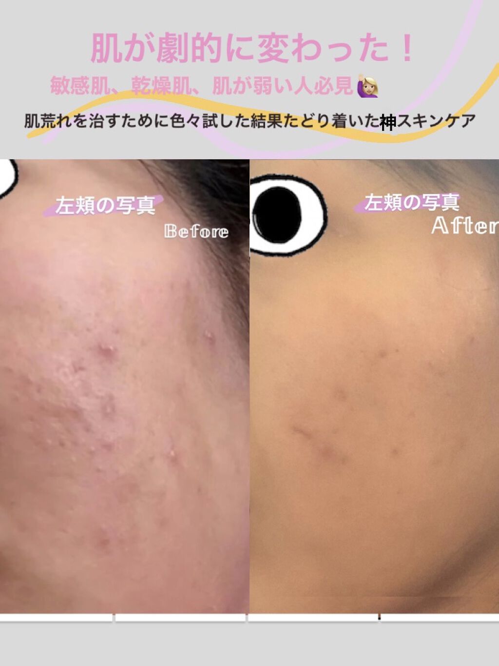 薬用 しみ 集中対策 美容液/メラノCC/美容液を使ったクチコミ（1枚目）