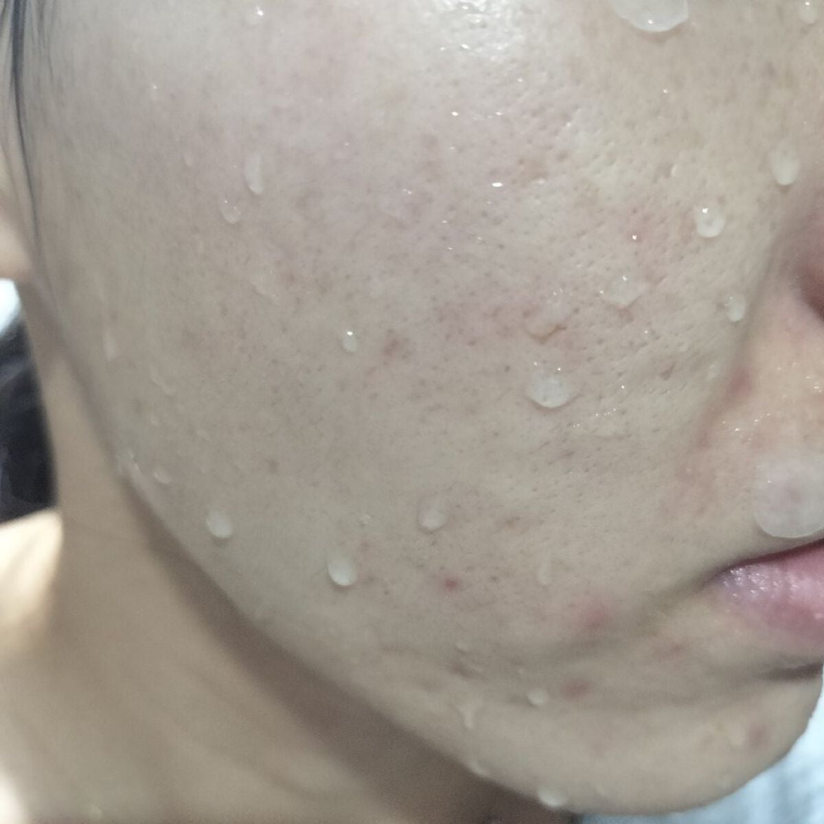 miina@汚肌工事録⚠️ on LIPS 「11/8の#汚肌工事録いつもお付き合いいただきありがとうござい..」(1枚目)