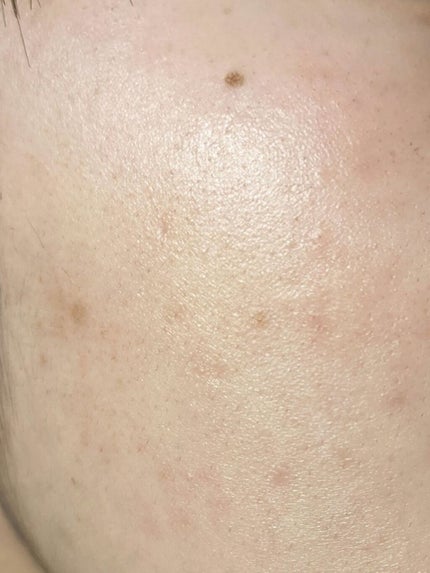 DHC はとむぎエキス/DHC/健康サプリメントを使ったクチコミ(9枚目)