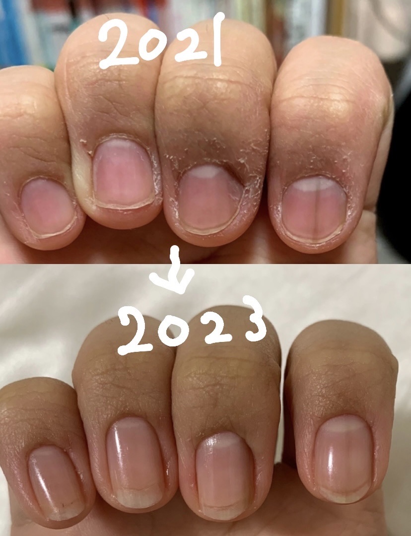 エテュセ クイックケアコート/ettusais/ネイルオイル・トリートメントを使ったクチコミ（1枚目）