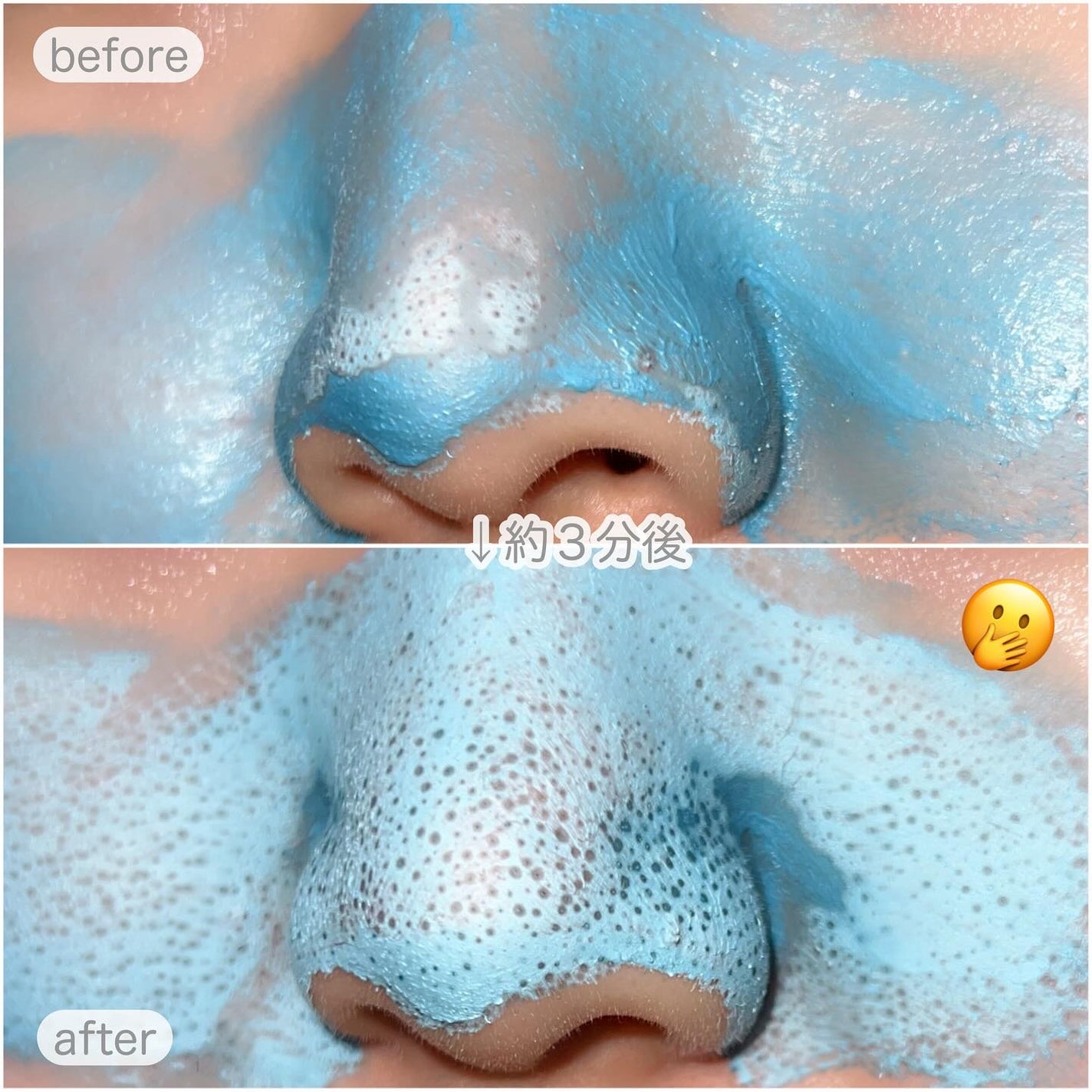 ゼロ毛穴クレイパック/MEDICUBE/洗い流すパック・マスクを使ったクチコミ(6枚目)