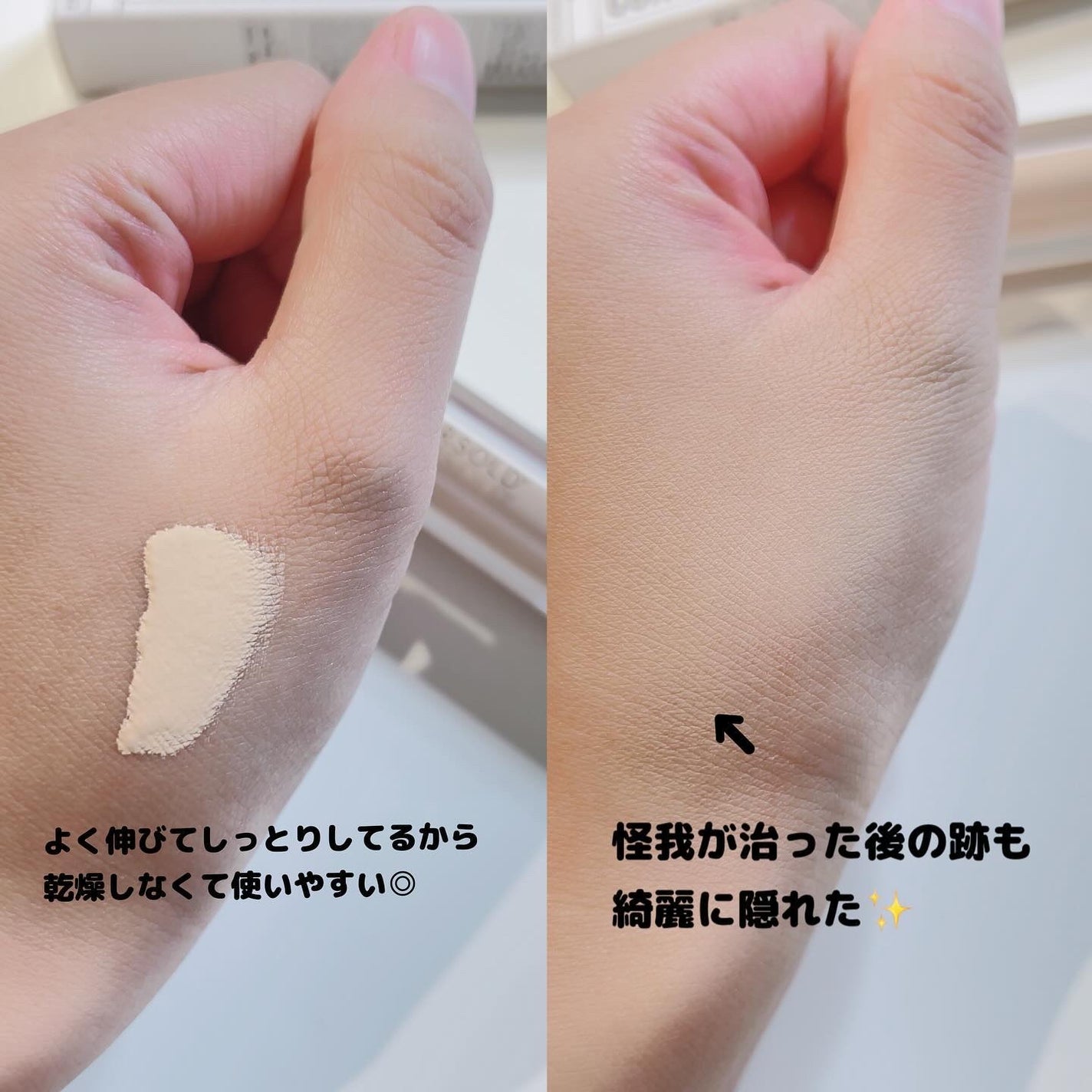 ダーマシンコンシーラー/23years old/リキッドコンシーラーを使ったクチコミ(2枚目)